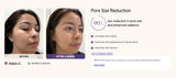 iRESTORE Illumina LED Red Light Therapy Face, Neck and Chest Mask Set