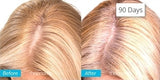 Theradome EVO Laser Hair Growth Helmet, FDA-Cleared Hair Restoration Device