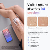 Braun Skin i-expert Pro 7 Smart IPL Women's Hair Removal System Kit with 3 Heads