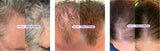 Dr. Groot Scalp Revitalizing Hair Loss Anti-Thinning Shampoo, 23.6 fl oz, 2-pack