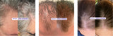 Dr. Groot Scalp Revitalizing Hair Loss Anti-Thinning Shampoo, 23.6 fl oz, 2-pack